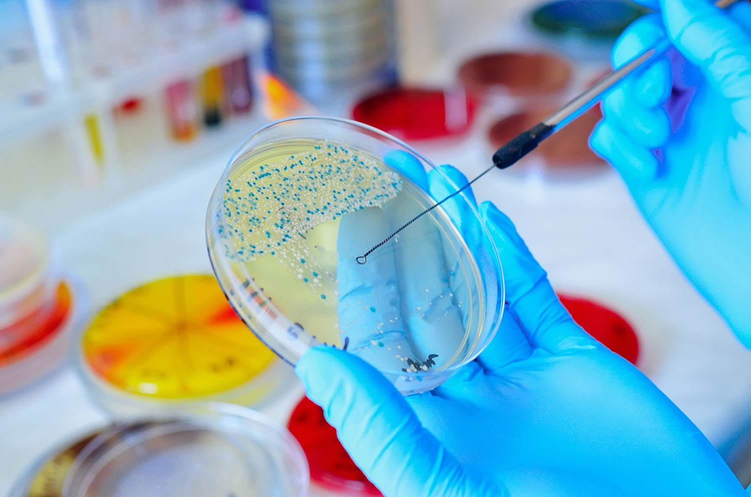 Petri dish. Microbiological laboratory. Mold and fungal cultures. Bacterial research