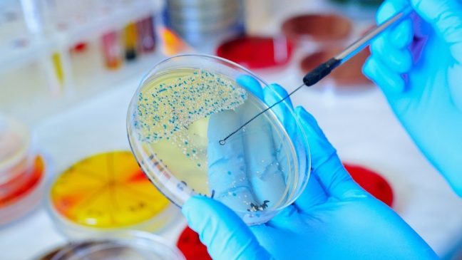 Petri dish. Microbiological laboratory. Mold and fungal cultures. Bacterial research